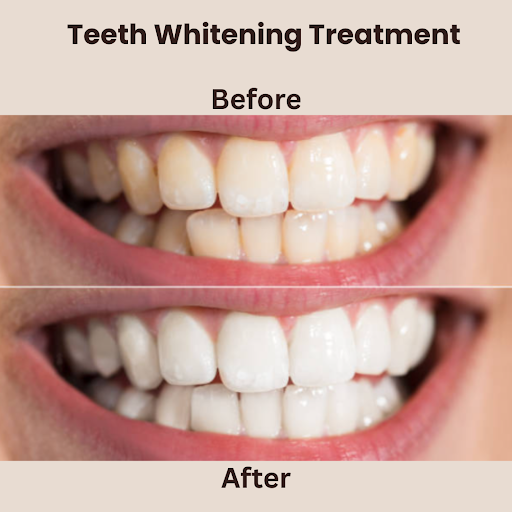 A happy patient showcasing a bright smile after receiving cosmetic dentistry and cosmetic dental treatment in South Delhi.